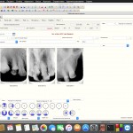 Программа для стоматологии Dental Soft-2: небольшой обзор